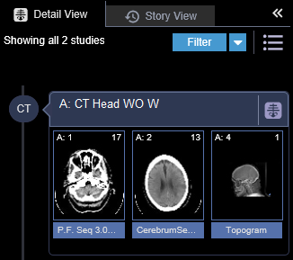 Detail View work area: Filter button, then a CT Head study on the timeline with three series thumbnails